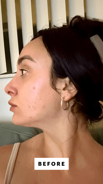 Selfie of Trakoshis before applying the SkinCeuticals Discoloration Defense